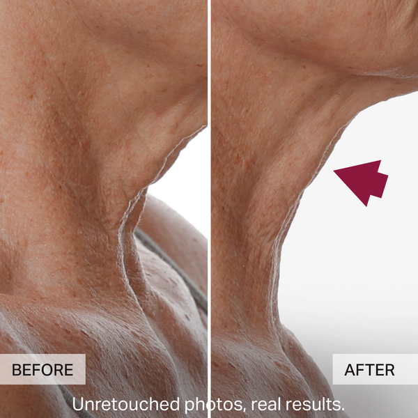 Before and after comparison of skin texture on a person's leg.