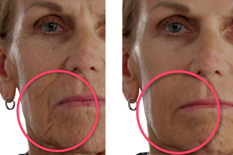 Side-by-side comparison of a woman's face with and without visible aging effects.