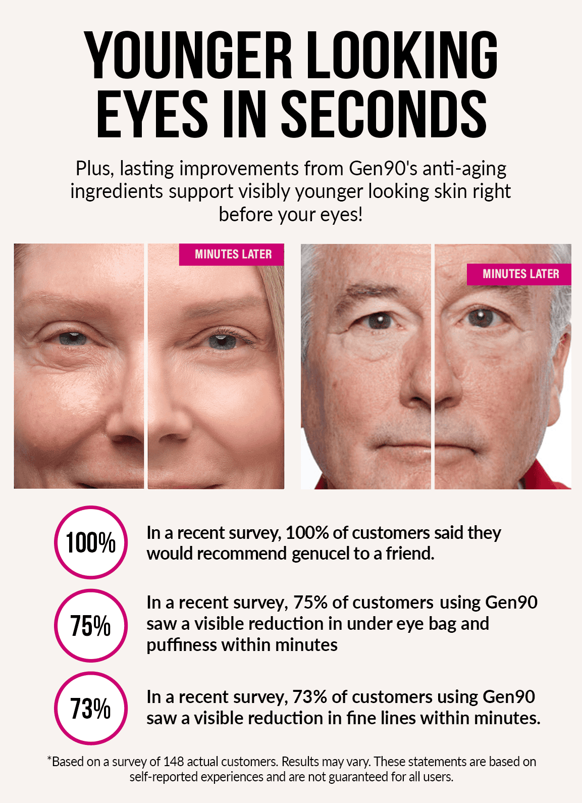 Advertisement for Gen90's anti-aging eye cream showing before and after effects on eyes.