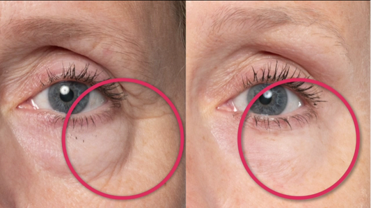 Before and after comparison of eye area with red circles highlighting differences.