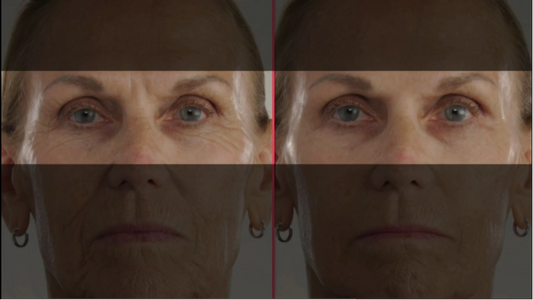 Side-by-side comparison of a woman's face with and without aging effects.