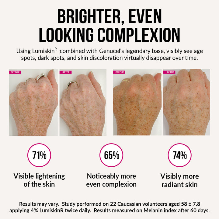 Side-by-side before and after images of hands showing visible reduction in age spots and skin discoloration after using Genucel with Lumiskin. Headline reads: 'Brighter, even looking complexion.' Supporting text states that the treatment helps visibly reduce age spots and dark spots over time. Survey results: 71% saw visible lightening of skin, 65% noticed a more even complexion, and 74% reported more radiant skin. Disclaimer notes study was performed on 22 Caucasian volunteers using 4% Lumiskin twice daily
