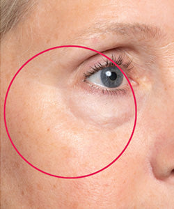 Crow's Feet after