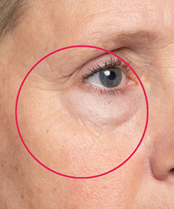 Crow's Feet before