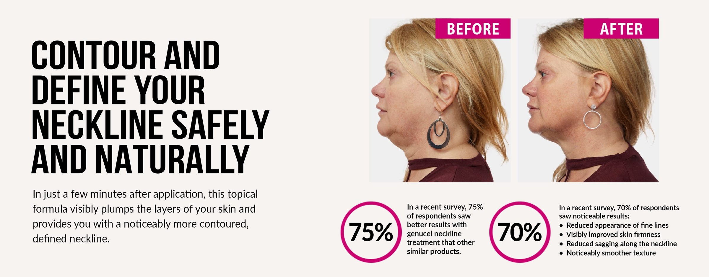 Advertisement showing a before and after comparison of neck contouring treatment.