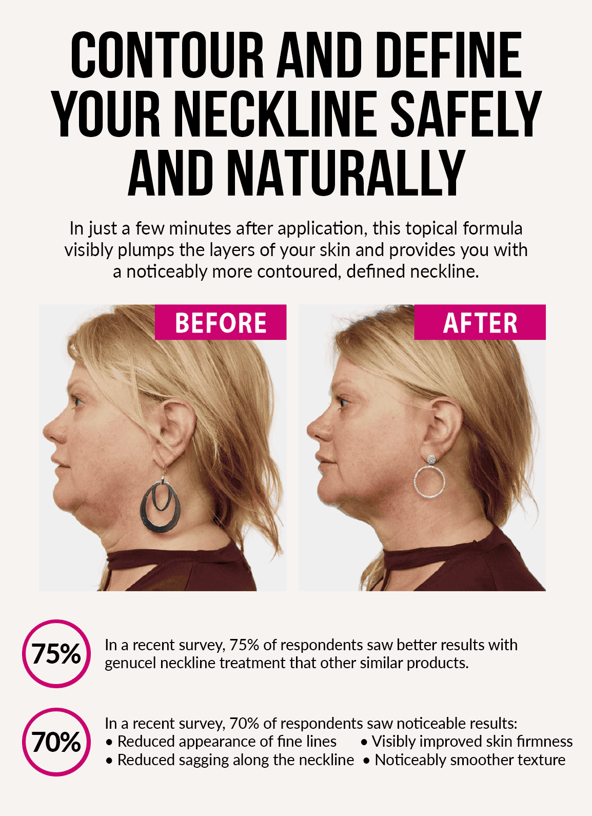 Before and after comparison of a neck treatment with text about results and survey data.